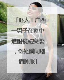 吓人！广西一男子在家中遭眼镜蛇突袭，伤处瞬间剧痛肿胀